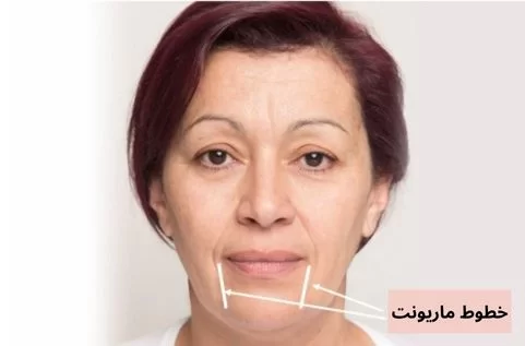 خط اندوه