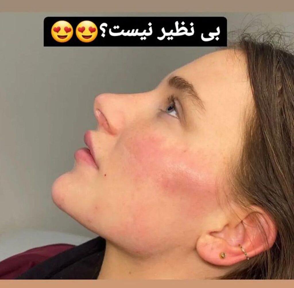 زاویه سازی صورت