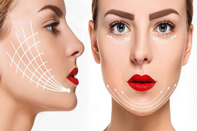 تزریق فیلر فول فیس