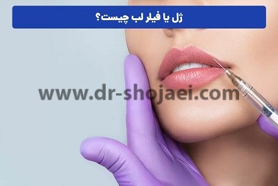 قیمت ژل لب